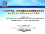 [TCT2011]COBRA试验：冷冻球囊或常规球囊镍钛合金支架扩张后进行外周动脉段的血运重建